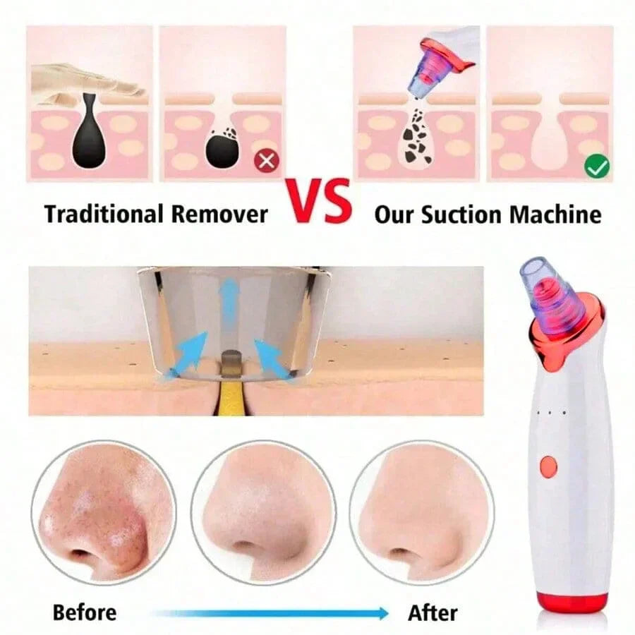 Electric Blackhead Remover Vacuum Cleaner