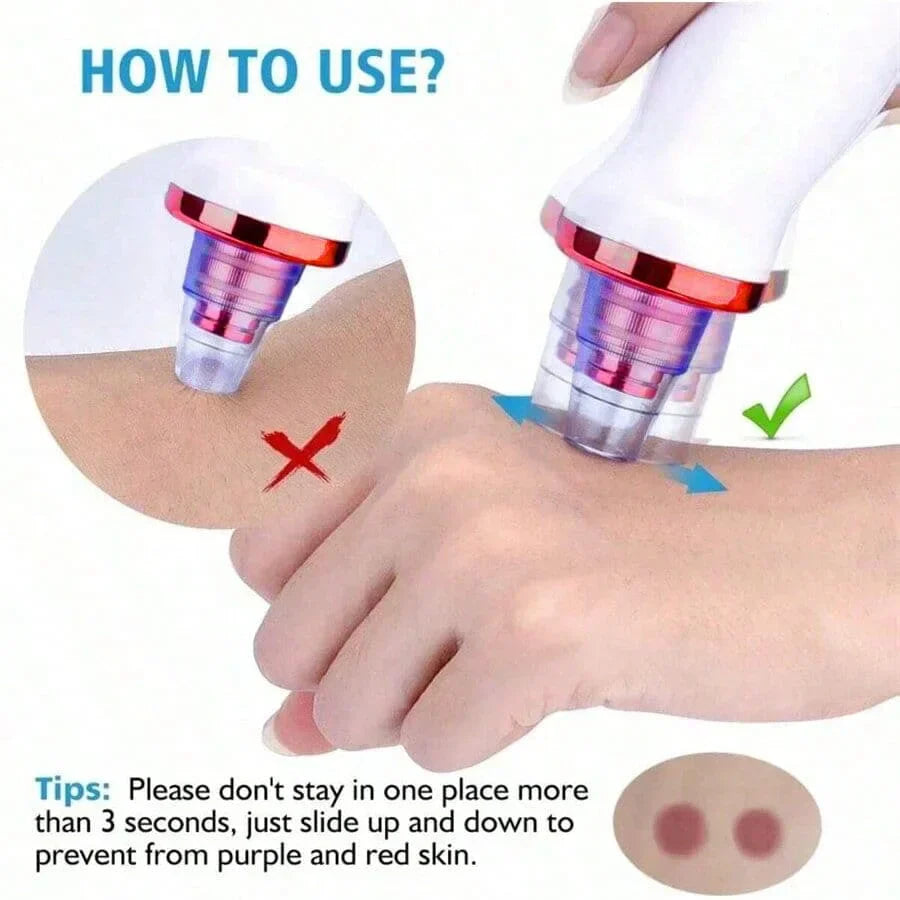 Electric Blackhead Remover Vacuum Cleaner