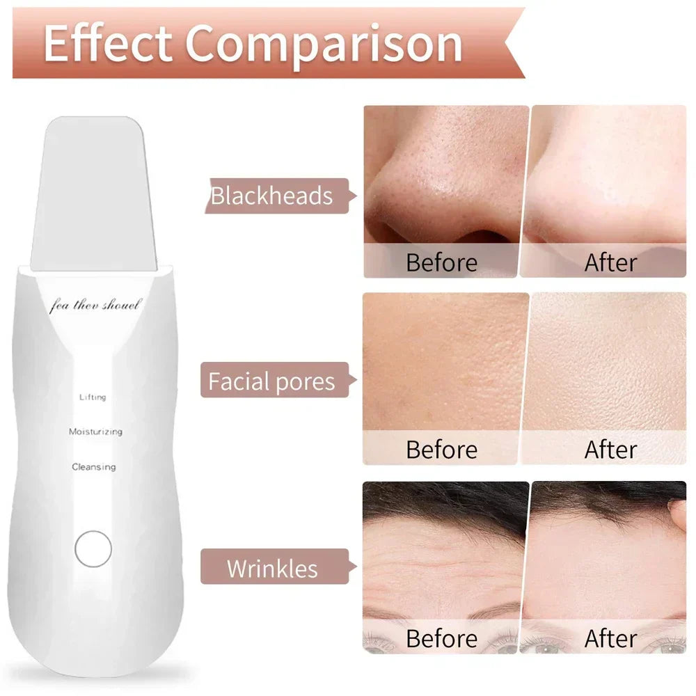 Electric Facial Skin Scrubber Spatula